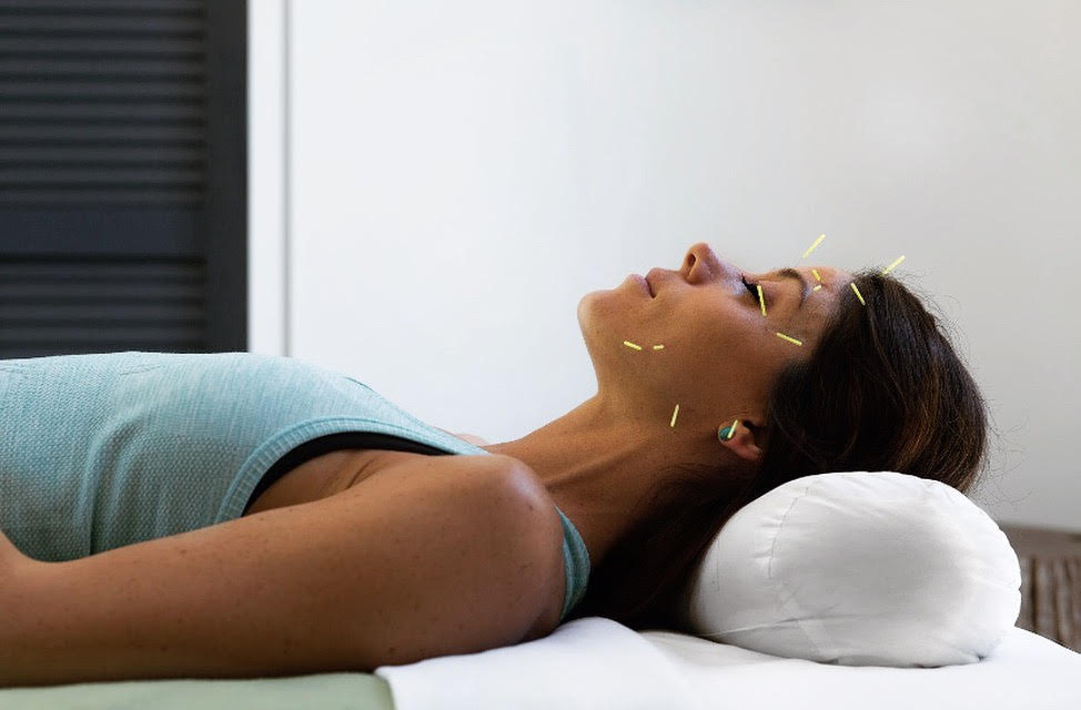 Awaken Now Acupuncture and Wellness Center Discover Los Angeles